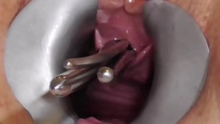 Amatør FreyjaAnalslut: stenger i Freyja er pisshole